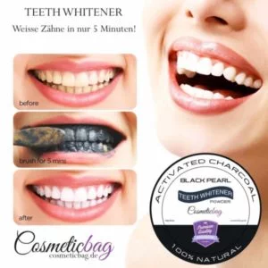 Aktivkohle Zahn Bleaching 30g